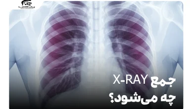 جمع X-ray چه می‌شود؟